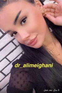5 سال بعد از عمل