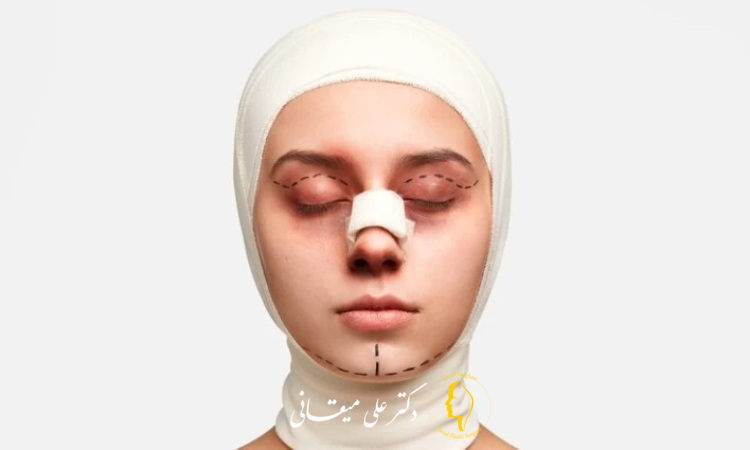 تأثیر شیاف دیکلوفناک بر کاهش کبودی و ورم بعد از عمل بینی