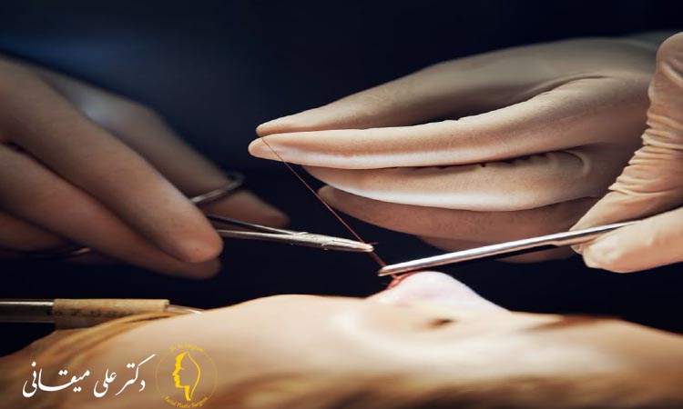 آیا روش بی حسی برروی نتیجه بینی تاثیر میذارد؟